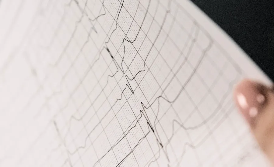 Looking at an ECG (electrocardiogram) test result. A hand holds up the results, lines of mountainous peaks and troughs on a piece of paper.