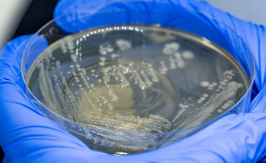 2 gloved hands holding a petri dish with bacteia growing 