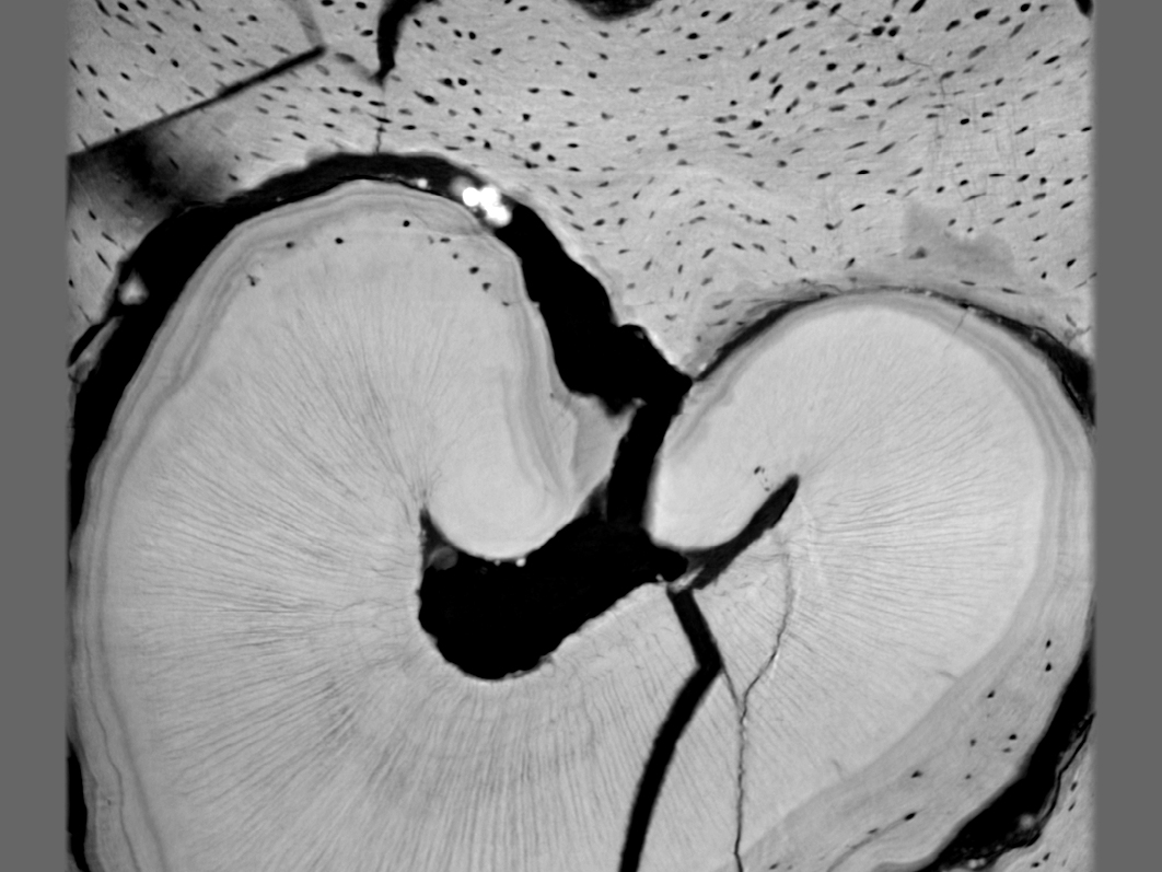 CT “slice” of a fossilized tooth root of the Upper Jurassic mammal species Haldanodon.