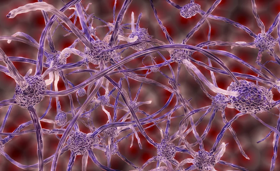 Purple neuron synapses.