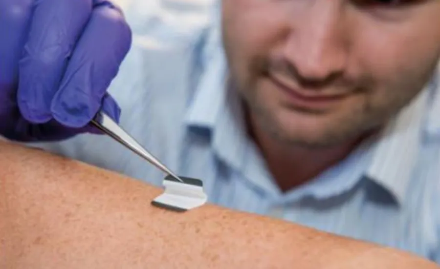 A health researcher swabs a patient's skin