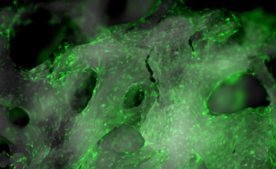 Microscope image of fluorescent cells on trabeculae