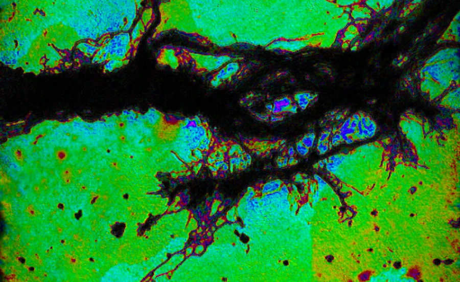 X-ray microscope image of a bundle of dendrites grown from a mouse neuron. The magnification is higher than possible using visible light.