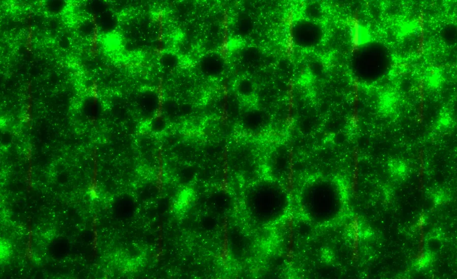 A pseudomonas aeruginosa biofilm, featuring dark circles pockmarking the surface. 