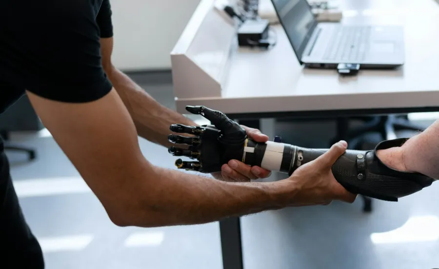 A patient has a prosthetic arm fitted