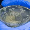 2 gloved hands holding a petri dish with bacteia growing 